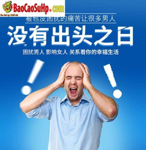 Bao cao su DonDen ForeSkin siêu mềm mượt tăng khoái cảm