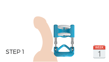 Máy tập tăng kích thước dương vật Pro Extender chuẩn Mỹ hiệu quả ngay