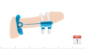 Máy tập tăng kích thước dương vật Pro Extender chuẩn Mỹ hiệu quả ngay