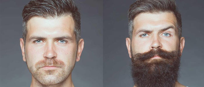 Minoxidil 5% Bọt Tăng Mọc Râu Nhanh, Hiệu Quả, An Toàn SHP972 Minoxidil 5% Bọt Tăng Mọc Râu Nhanh, Hiệu Quả, An Toàn SHP972