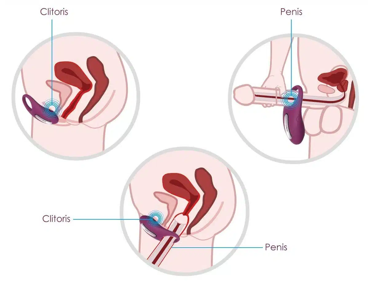 Vòng Rung Svakom Wini Điều Khiển Từ Xa Tăng Khoái Cảm Cực Mạnh